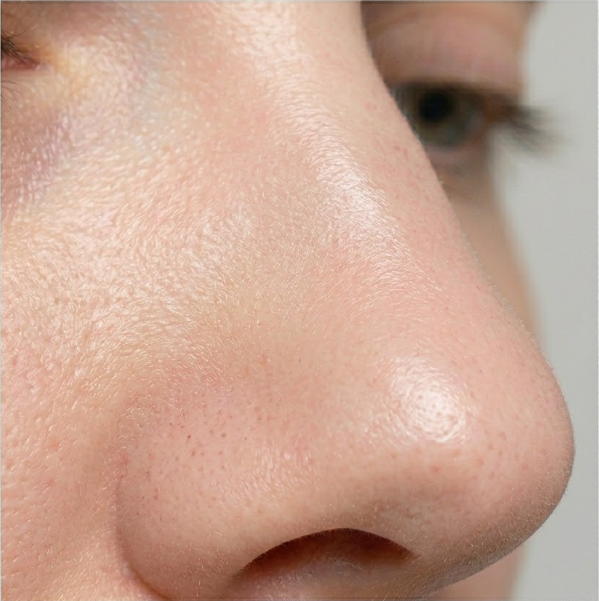 After treatment